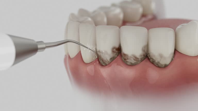 Trusted Wisdom Tooth Removal service in Long Grove, IL - Dentist Open Now